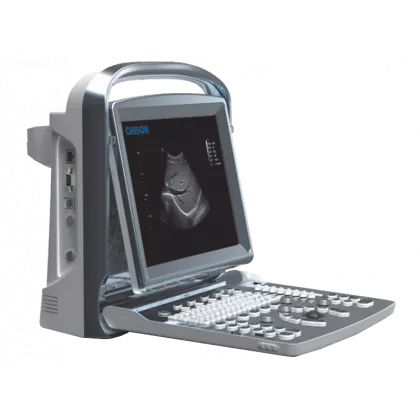 Echographe portable à ultrasons Chison ECO1